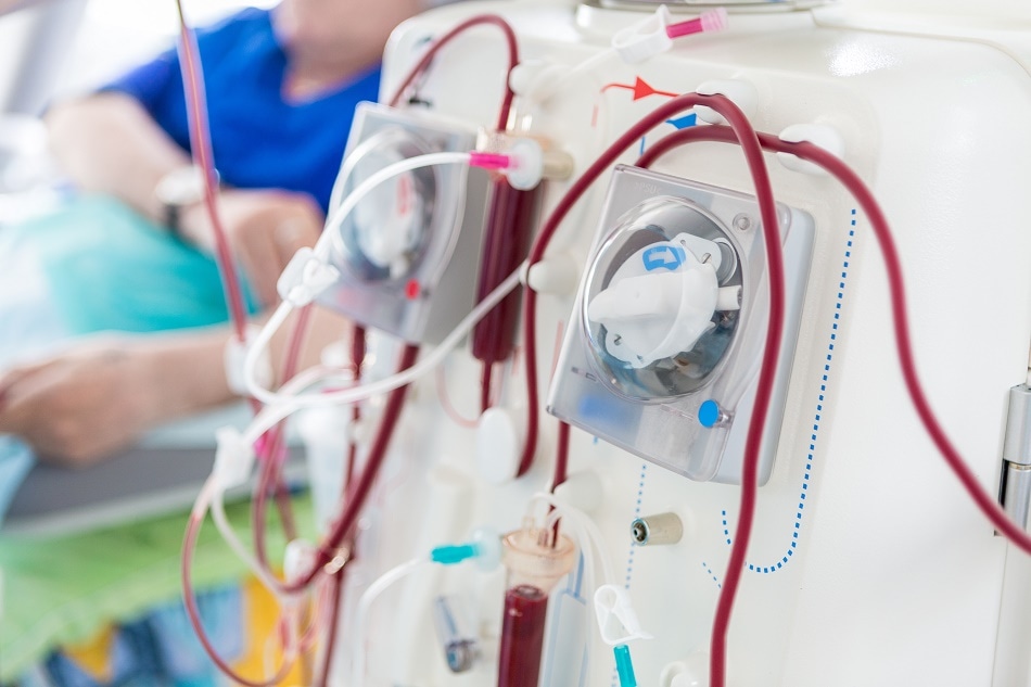 Sensors play a huge role in kidney dialysis system