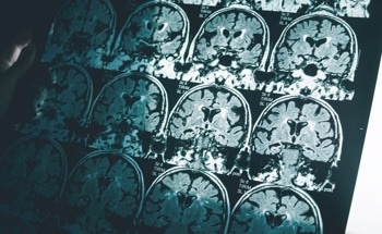 Could Sensors Help Detect Alzheimer's Disease?