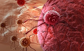 Improving Cancer Screening in Patients Using Implantable Sensors