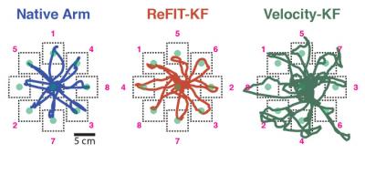 ReFIT Algorithm Improves Speed and Accuracy of Neural Prosthetics that Control Computer Cursors