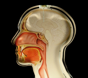 Novel Sensor Implanted in the Brain Monitors Cerebral Pressure