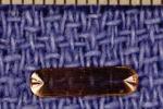 Researchers Test Wireless Sensors Incorporated into Orthopedic Implants for Detecting Surgical Site Infections