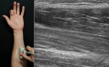 Future Wearable Devices Could Use Ultrasound Imaging to Sense Hand Gestures