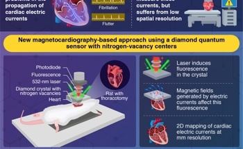 Measuring Currents in the Heart at Millimeter Resolution with a Diamond Quantum Sensor