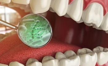 Using an Enhanced Electronic Tongue for Dental Bacterial Discrimination
