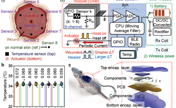 Biodegradable Sensors Monitor Temperature for Personalized Treatment